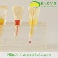 EN-M6 Best Price Dental Pulp Disease Clinical Model from Manufacturer Directly